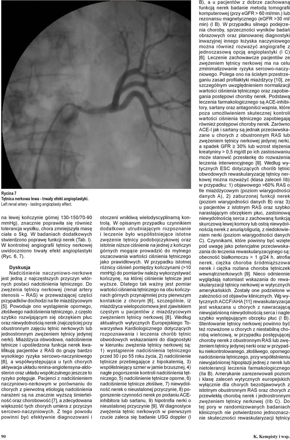 I). W kontrolnej angiografii tętnicy nerkowej uwidoczniono trwały efekt angioplastyki (Ryc. 6, 7).