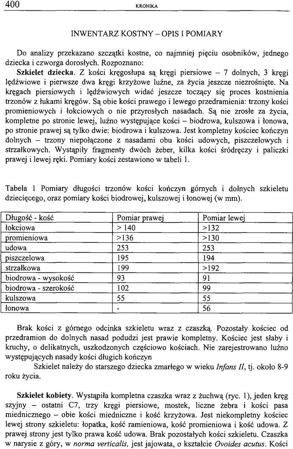 Na kręgach piersiowych i lędźwiowych widać jeszcze toczący się proces kostnienia trzonów z łukami kręgów.