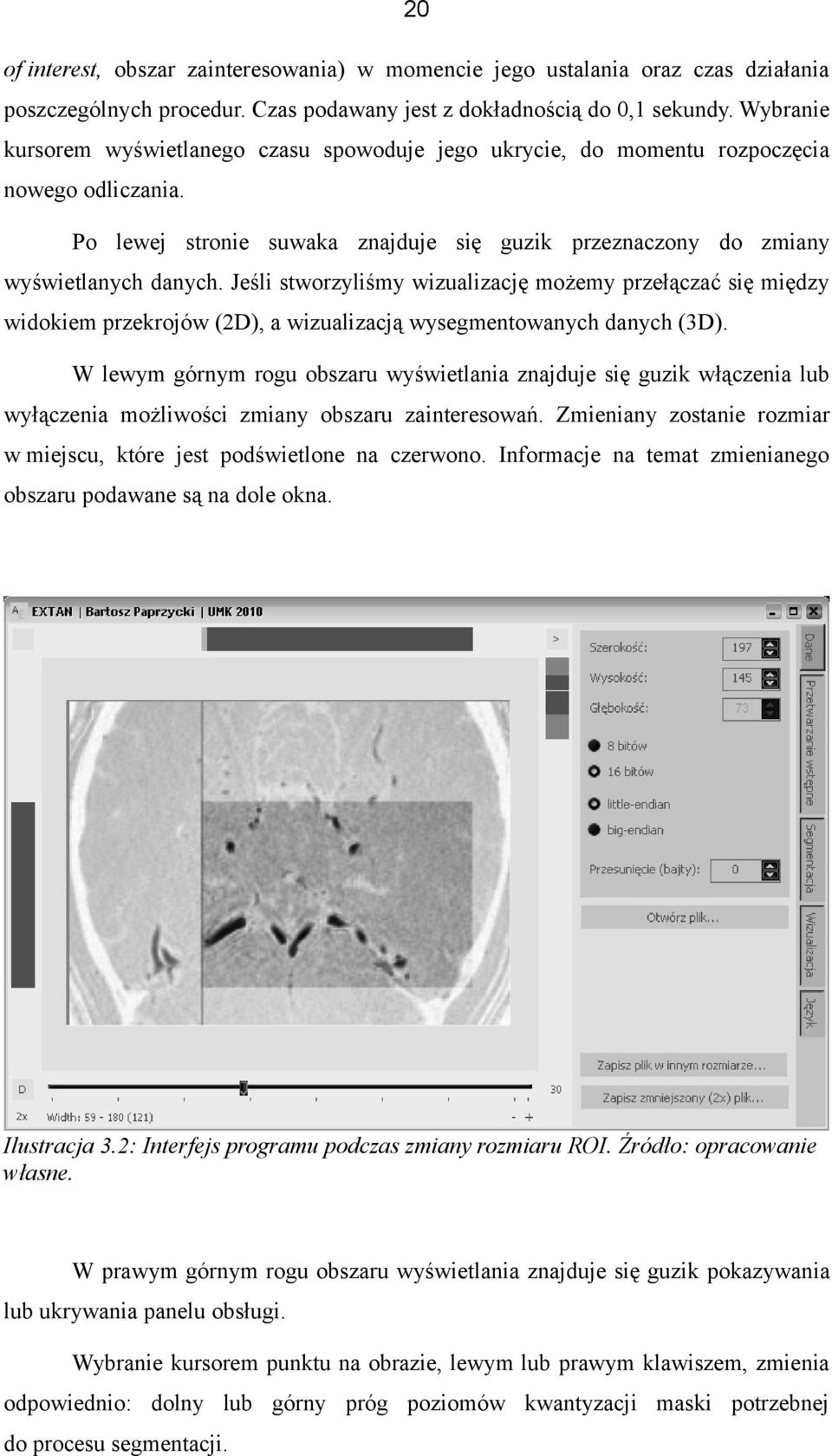 Jeśli stworzyliśmy wizualizację możemy przełączać się między widokiem przekrojów (2D), a wizualizacją wysegmentowanych danych (3D).