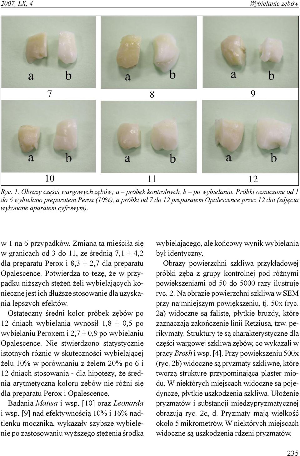 Zmiana ta mieściła się w granicach od do, ze średnią 7,1 ±, dla preparatu Perox i, ±,7 dla preparatu Opalescence.