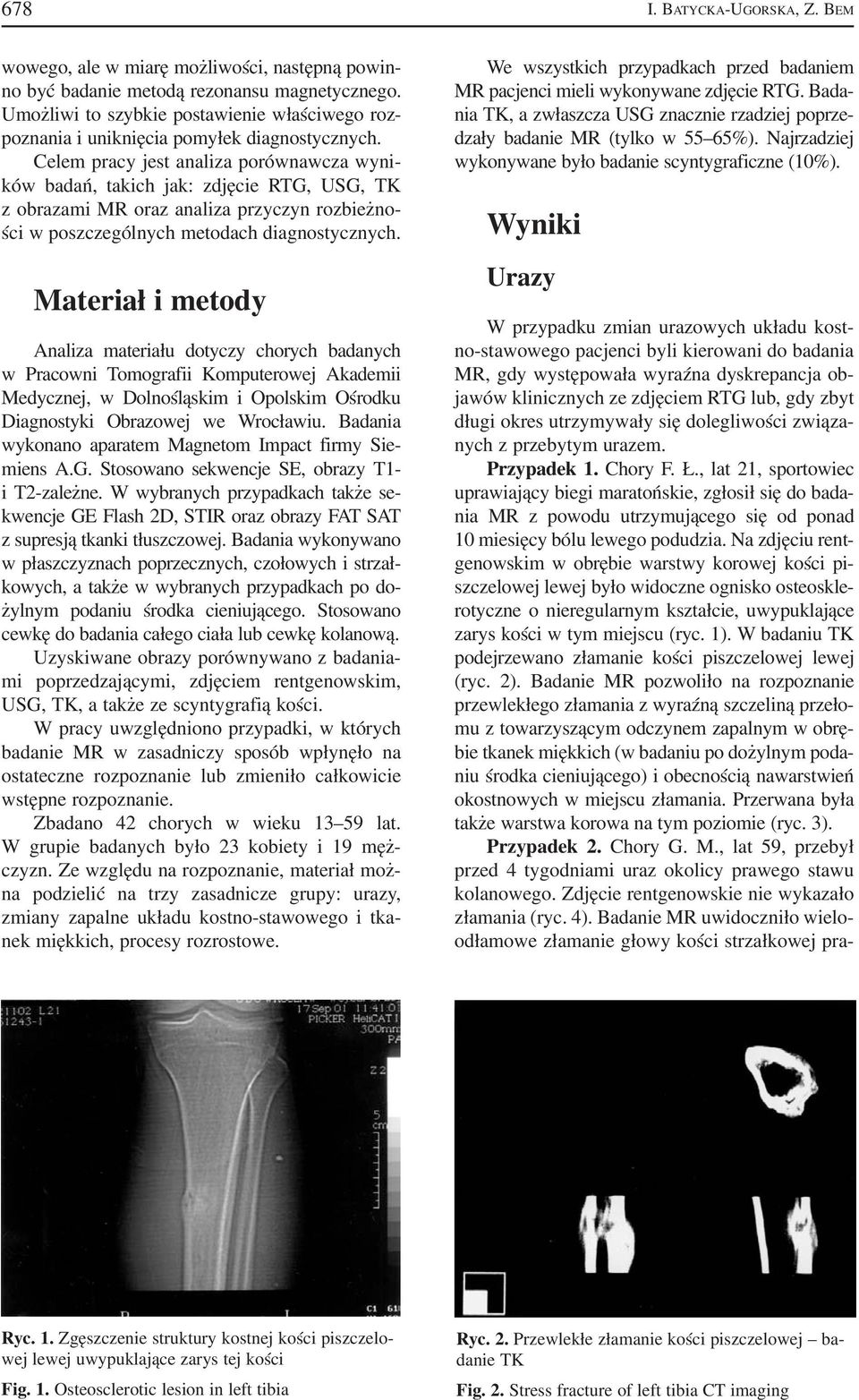 Celem pracy jest analiza porównawcza wyni ków badań, takich jak: zdjęcie RTG, USG, TK z obrazami MR oraz analiza przyczyn rozbieżno ści w poszczególnych metodach diagnostycznych.