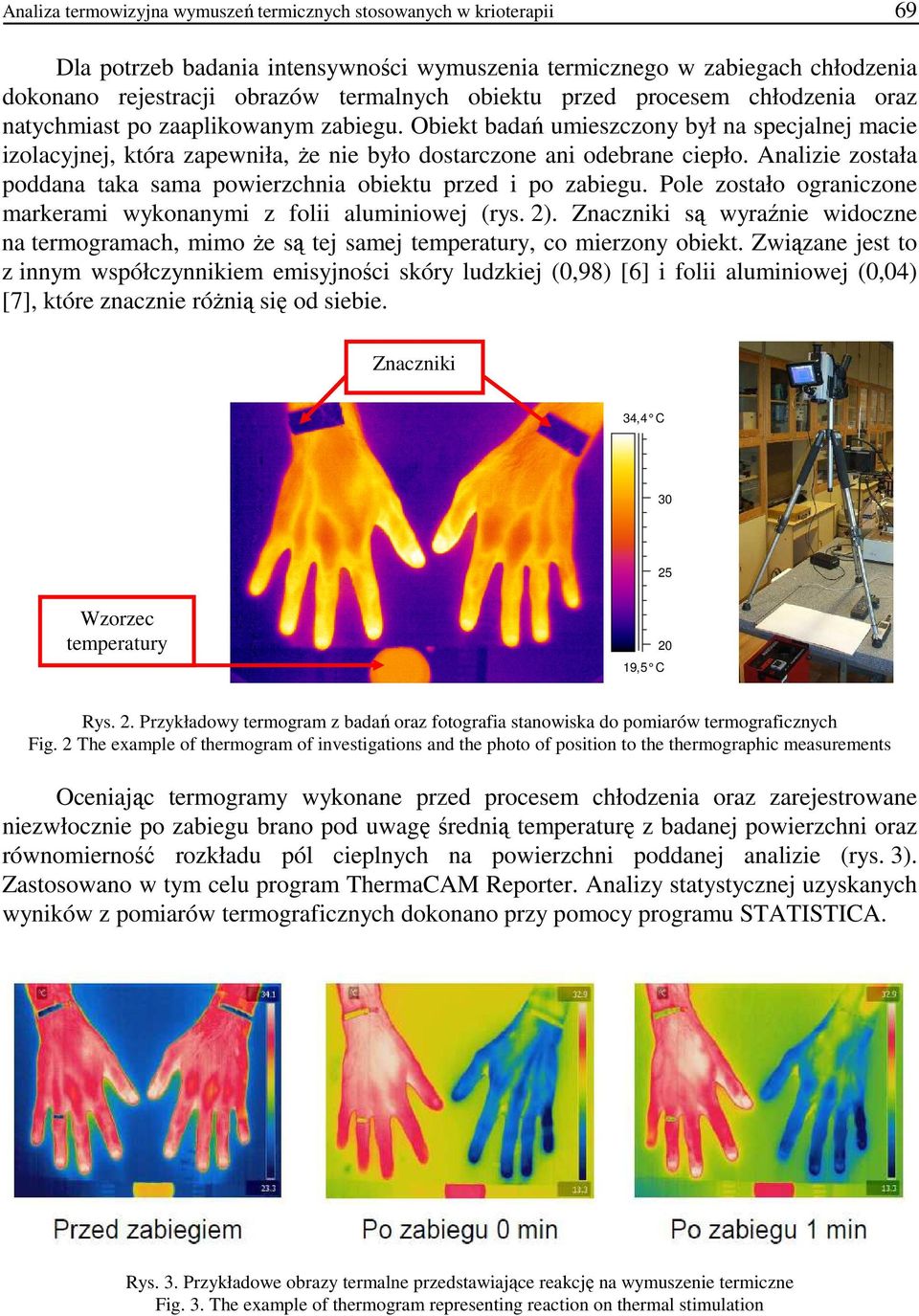 Analizie została poddana taka sama powierzchnia obiektu przed i po zabiegu. Pole zostało ograniczone markerami wykonanymi z folii aluminiowej (rys. 2).