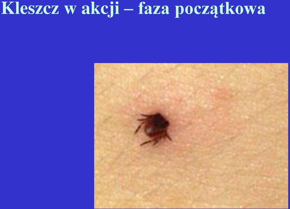 faza