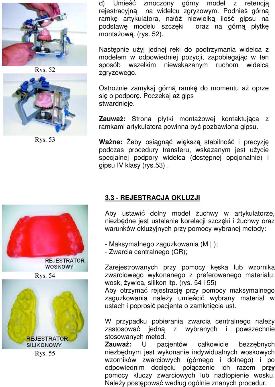 OstroŜnie zamykaj górną ramkę do momentu aŝ oprze się o podporę. Poczekaj aŝ gips stwardnieje. ZauwaŜ: Strona płytki montaŝowej kontaktująca z ramkami artykulatora powinna być pozbawiona gipsu. Rys.