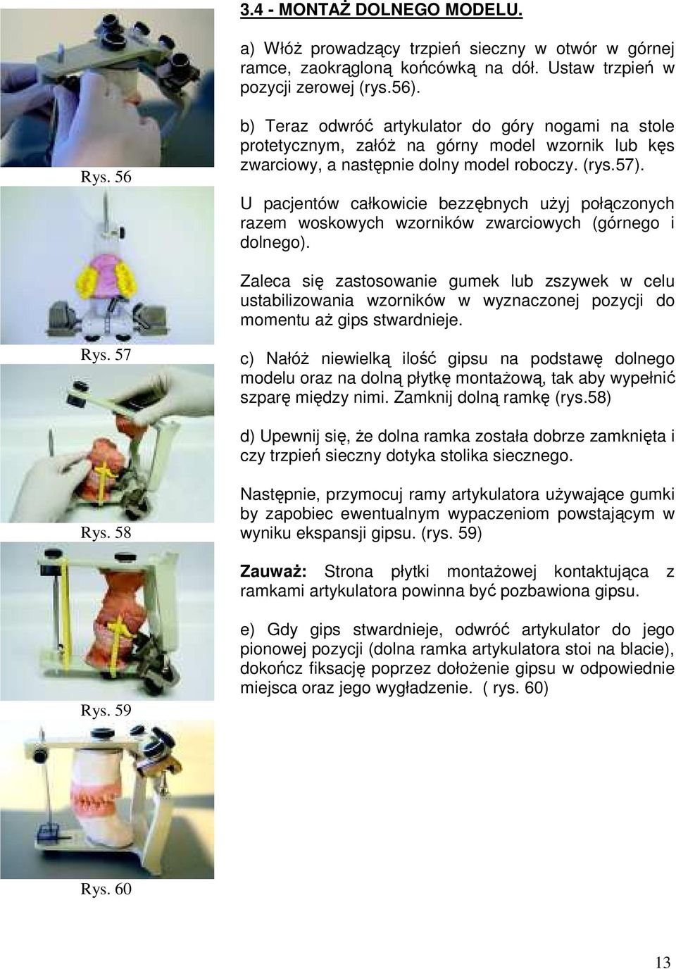 U pacjentów całkowicie bezzębnych uŝyj połączonych razem woskowych wzorników zwarciowych (górnego i dolnego).