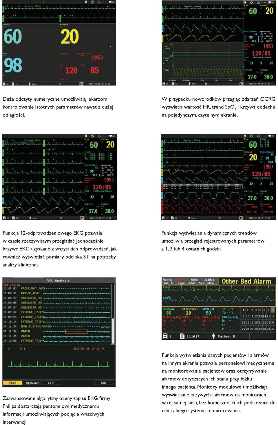 Funkcja 12-odprowadzeniowego EKG pozwala w czasie rzeczywistym przeglądać jednocześnie krzywe EKG uzyskane z wszystkich odprowadzeń, jak również wyświetlać pomiary odcinka ST na potrzeby analizy