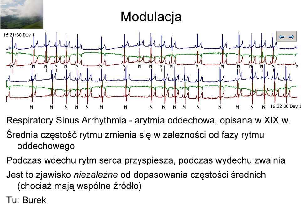 Podczas wdechu rytm serca przyspiesza, podczas wydechu zwalnia Jest to