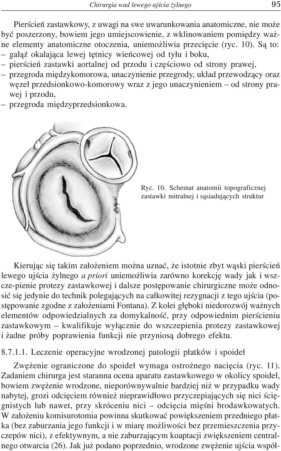 S¹ to: ga³¹ÿ okalaj¹ca lewej têtnicy wieñcowej od ty³u i boku, pierœcieñ zastawki aortalnej od przodu i czêœciowo od strony prawej, przegroda miêdzykomorowa, unaczynienie przegrody, uk³ad przewodz¹cy