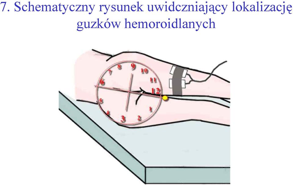 uwidczniający