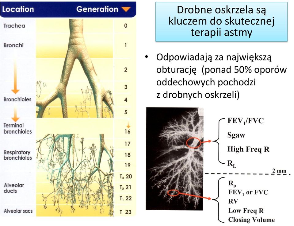 oddechowych pochodzi z drobnych oskrzeli) Yanai M i wsp.; J.