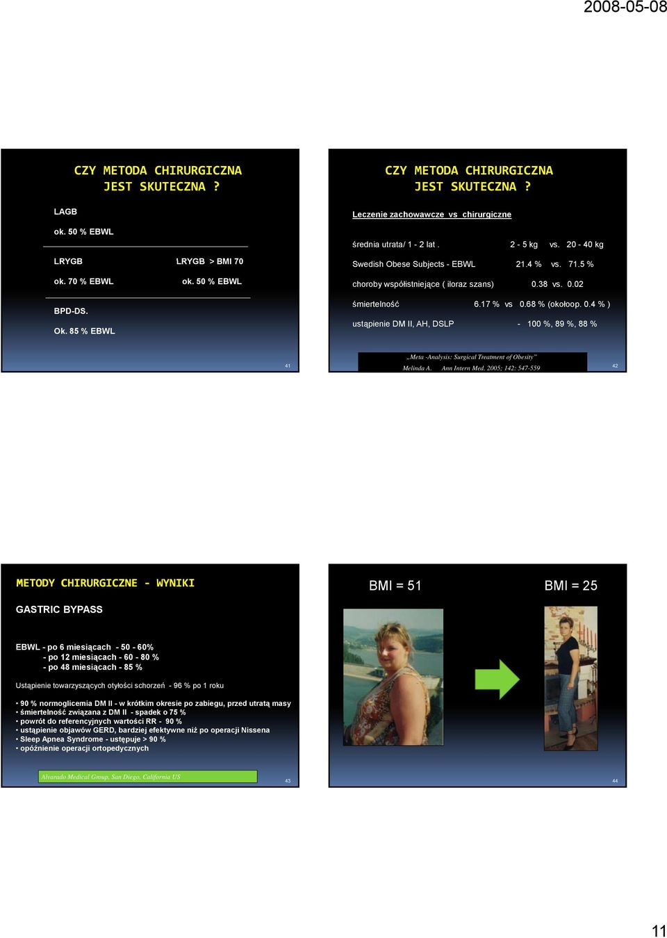 0.4 % ) ustąpienie DM II, AH, DSLP - 100 %, 89 %, 88 % 41 Meta -Analysis: Surgical Treatment of Obesity Melinda A. Ann Intern Med.
