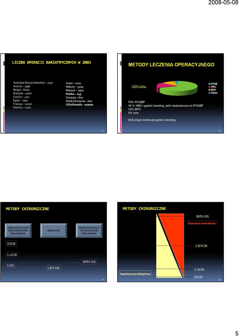 gastric banding, jeśli nieskuteczne to RYGBP 12% BPD 3% inne W Europie dominuje gastric banding 17 18 METODY CHIRURGICZNE METODY CHIRURGICZNE BPD-DS Ingerencja