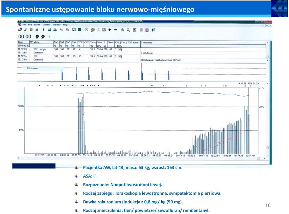 Rodzaj zabiegu: Torakoskopia lewostronna, sympatektomia piersiowa.