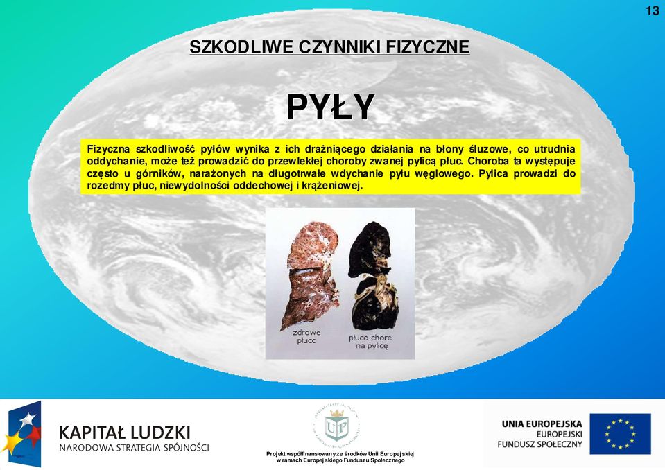 choroby zwanej pylicą płuc.