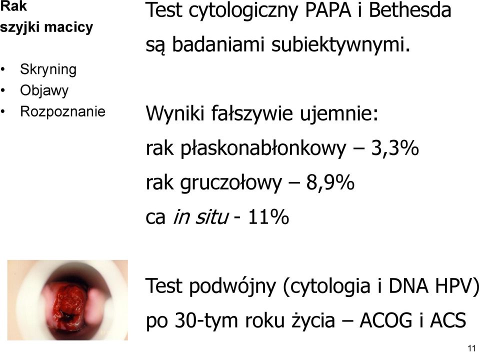 Wyniki fałszywie ujemnie: rak płaskonabłonkowy 3,3% rak