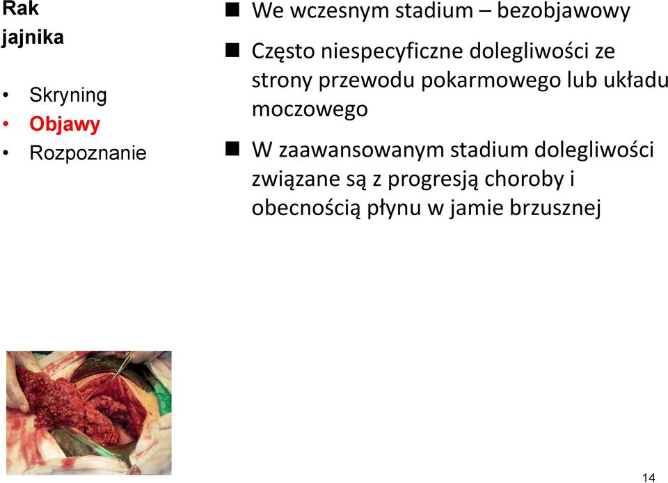 lub układu moczowego W zaawansowanym stadium dolegliwości