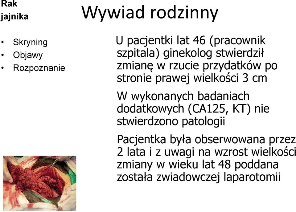 dodatkowych (CA125, KT) nie stwierdzono patologii Pacjentka była obserwowana przez 2