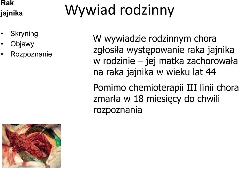 zachorowała na raka jajnika w wieku lat 44 Pomimo