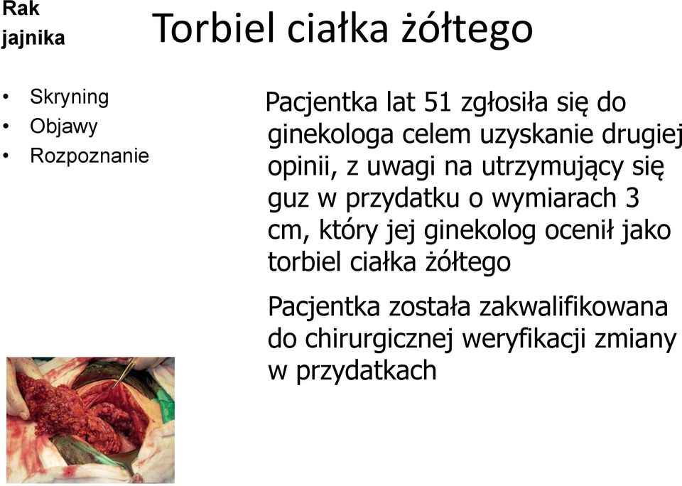 wymiarach 3 cm, który jej ginekolog ocenił jako torbiel ciałka żółtego