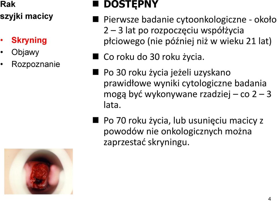 Po 30 roku życia jeżeli uzyskano prawidłowe wyniki cytologiczne badania mogą być wykonywane