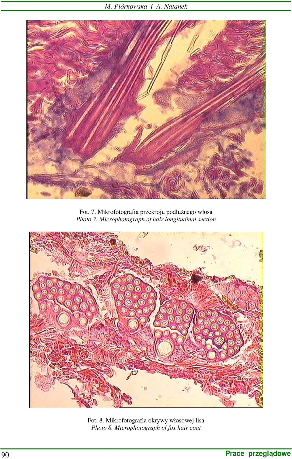 Microphotograph of hair longitudinal section Fot. 8.