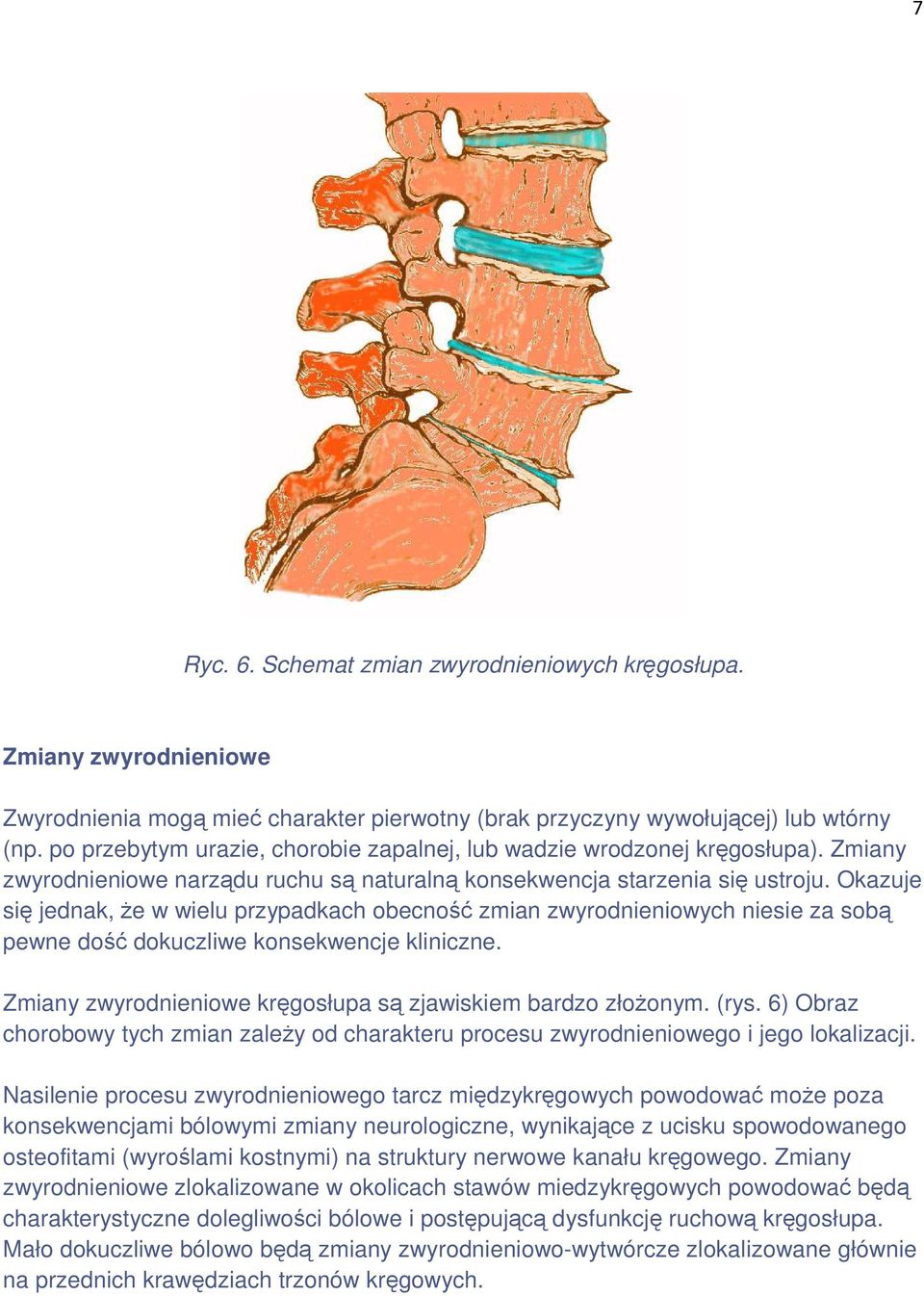 Okazuje się jednak, Ŝe w wielu przypadkach obecność zmian zwyrodnieniowych niesie za sobą pewne dość dokuczliwe konsekwencje kliniczne. Zmiany zwyrodnieniowe kręgosłupa są zjawiskiem bardzo złoŝonym.