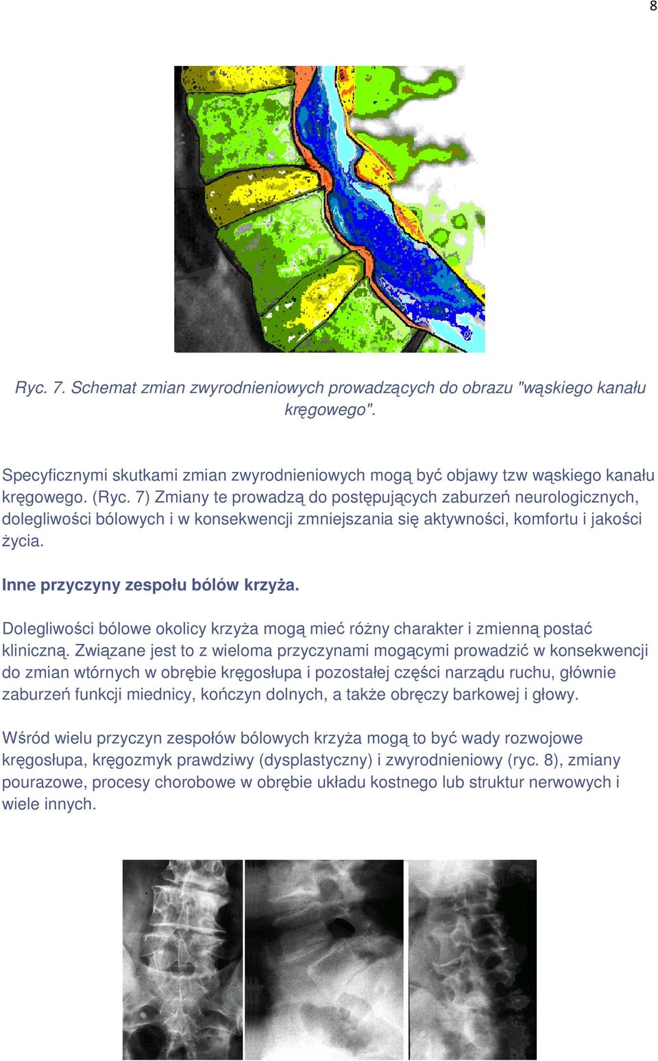 Dolegliwości bólowe okolicy krzyŝa mogą mieć róŝny charakter i zmienną postać kliniczną.