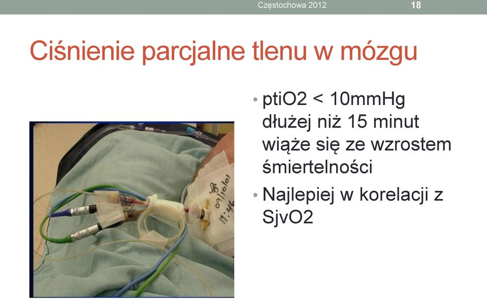 dłużej niż 15 minut wiąże się ze