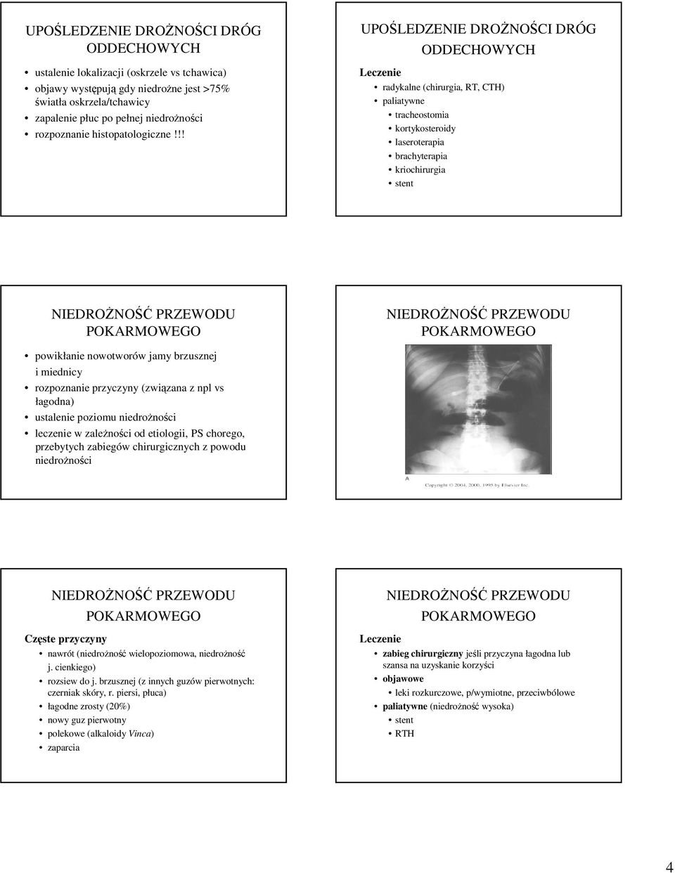 !! UPOŚLEDZE DROŻNOŚCI DRÓG ODDECHOWYCH radykalne (chirurgia, RT, CTH) paliatywne tracheostomia kortykosteroidy laseroterapia brachyterapia kriochirurgia stent powikłanie nowotworów jamy brzusznej i