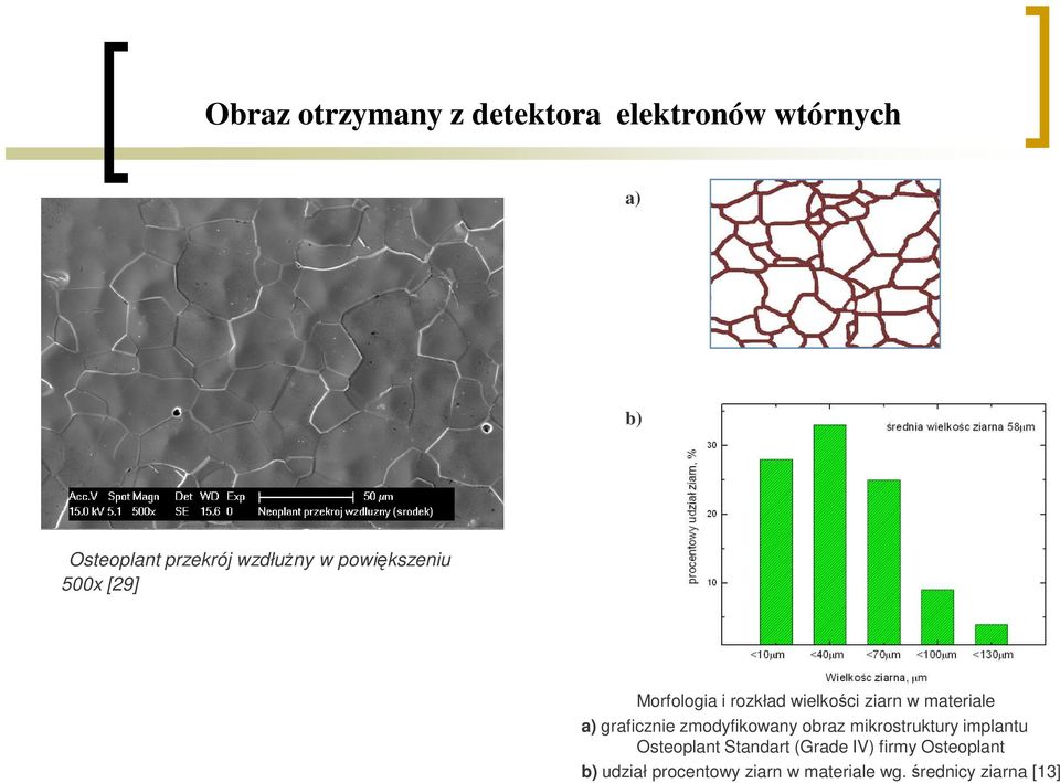 materiale a) graficznie zmodyfikowany obraz mikrostruktury implantu Osteoplant