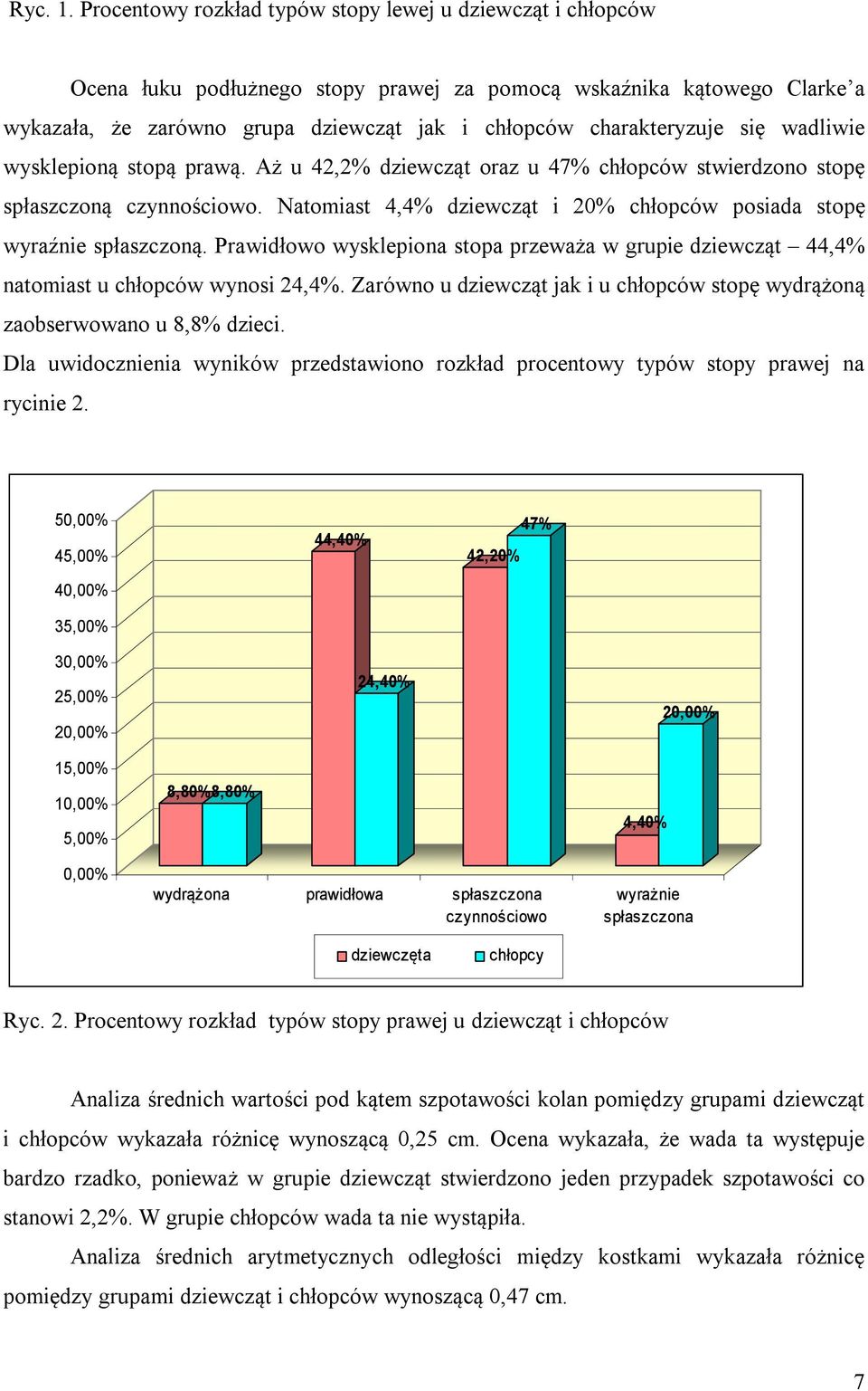 się wadliwie wysklepioną stopą prawą. Aż u 42,2% dziewcząt oraz u 47% chłopców stwierdzono stopę spłaszczoną czynnościowo. Natomiast 4,4% dziewcząt i 20% chłopców posiada stopę wyraźnie spłaszczoną.