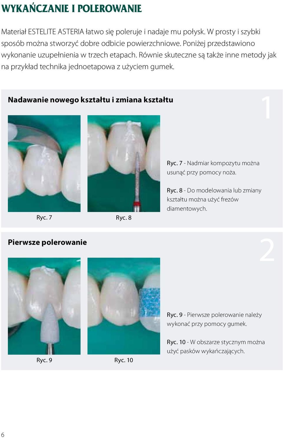 Nadawanie nowego kształtu i zmiana kształtu 1 Ryc. 7 - Nadmiar kompozytu można usunąć przy pomocy noża. Ryc. 7 Ryc. 8 Ryc.