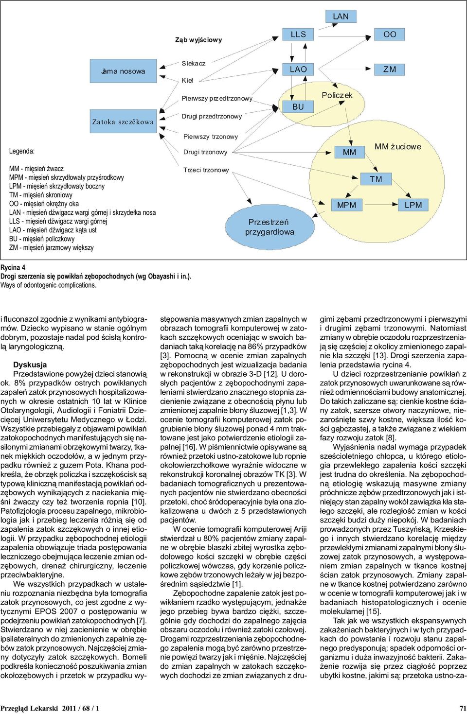 Ways of odontogenic complications. i fluconazol zgodnie z wynikami antybiogramów. Dziecko wypisano w stanie ogólnym dobrym, pozostaje nadal pod œcis³¹ kontrol¹ laryngologiczn¹.
