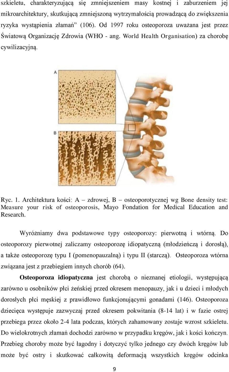 Wyróżniamy dwa podstawowe typy osteoporozy: pierwotną i wtórną.