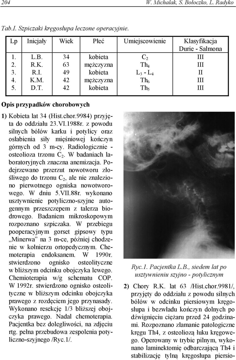 W badaniach laboratoryjnych znaczna anemizacja. Podejrzewano przerzut nowotworu złośliwego do trzonu C 2, ale nie znaleziono pierwotnego ogniska nowotworowego. W dniu 5.VII.88r.