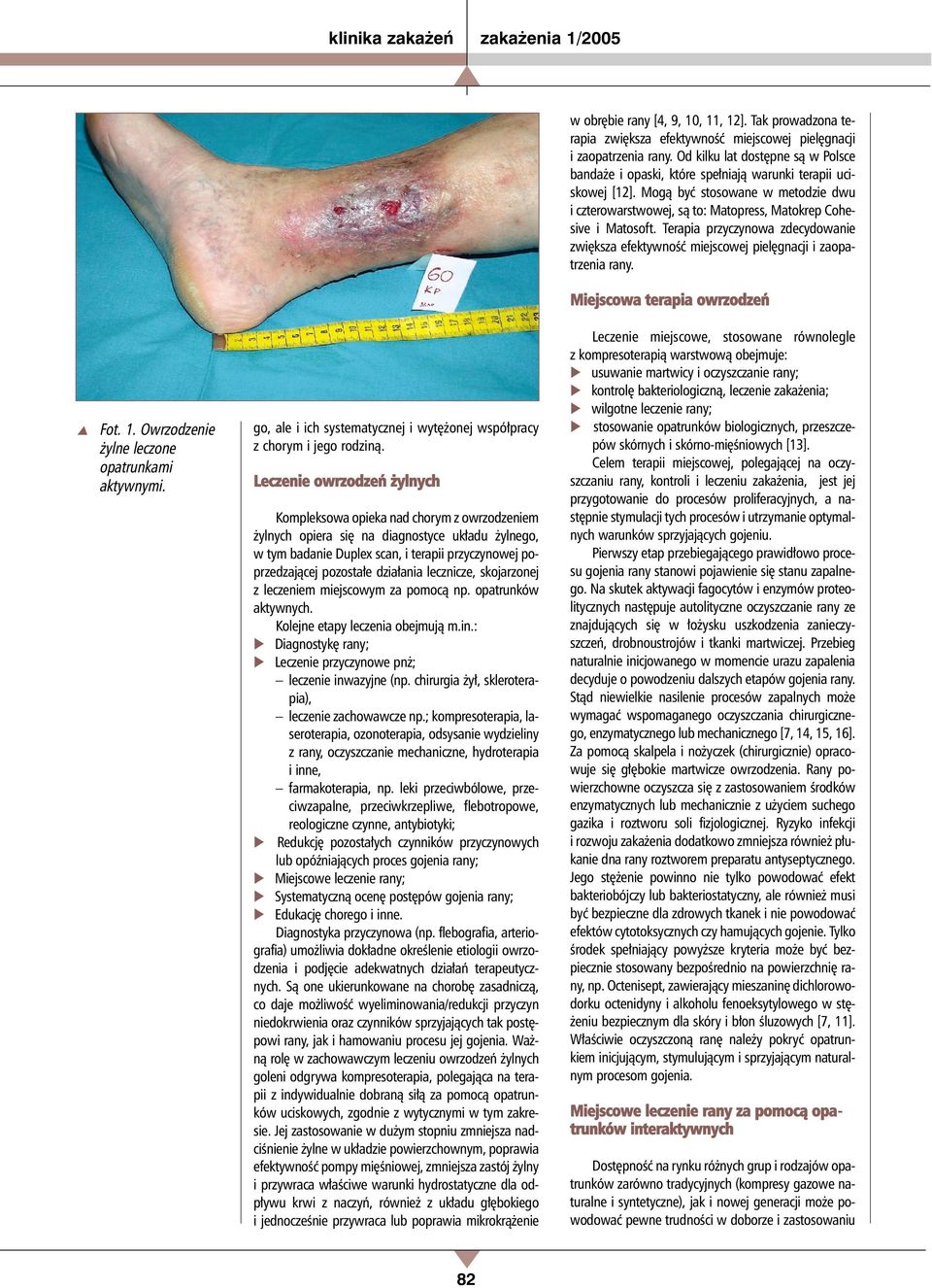 działania lecznicze, skojarzonej z leczeniem miejscowym za pomocą np. opatrunków aktywnych. Kolejne etapy leczenia obejmują m.in.: Diagnostykę rany; Leczenie przyczynowe pnż; leczenie inwazyjne (np.