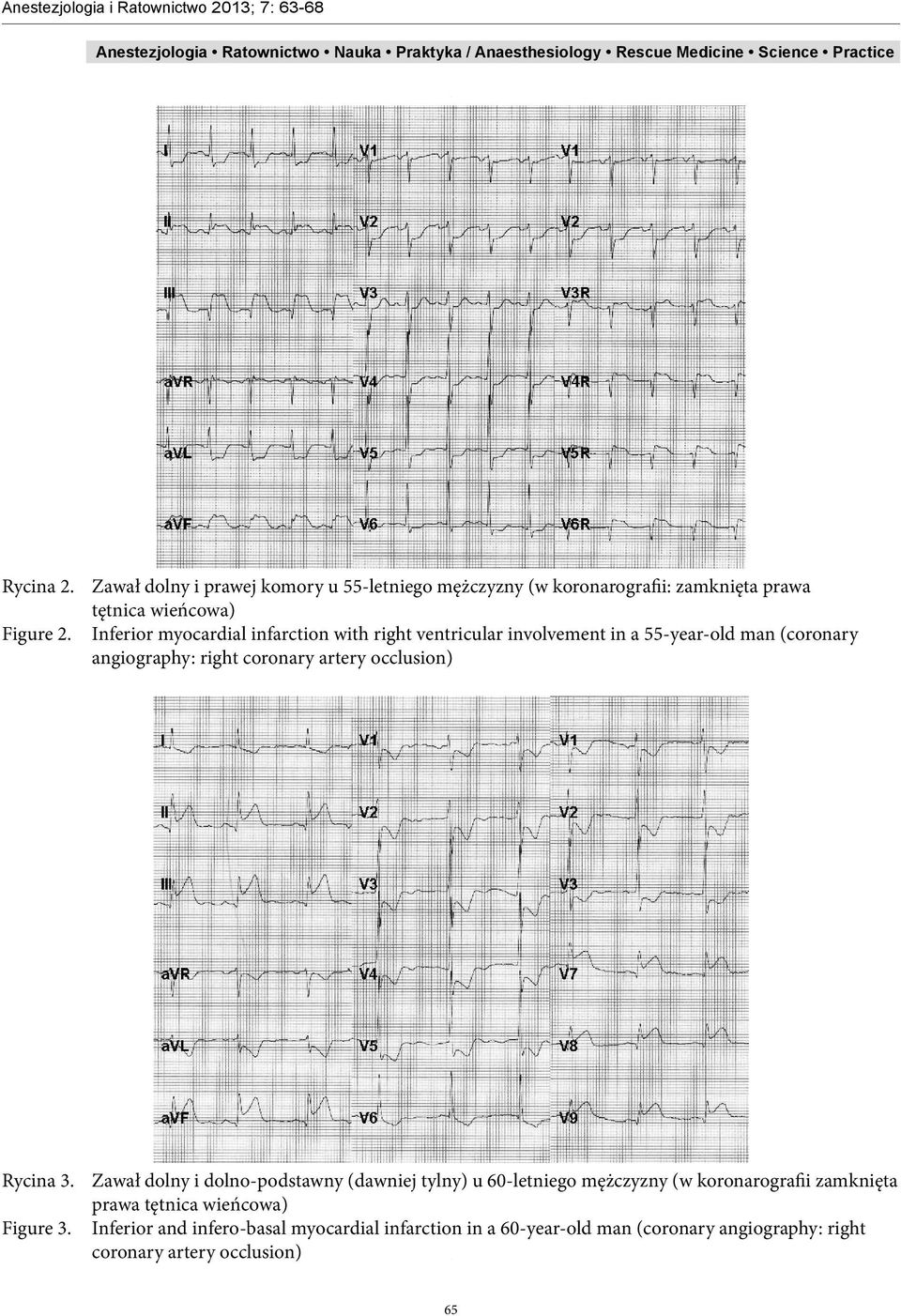 occlusion) Rycina 3.