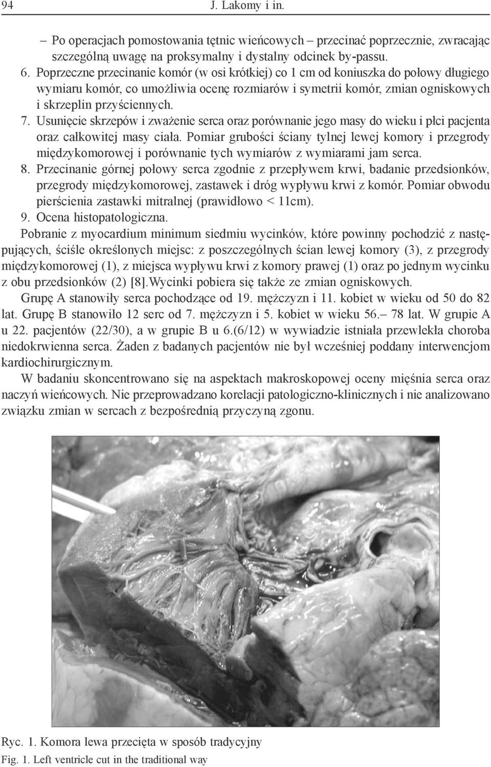Usunięcie skrzepów i zważenie serca oraz porównanie jego masy do wieku i płci pacjenta oraz całkowitej masy ciała.