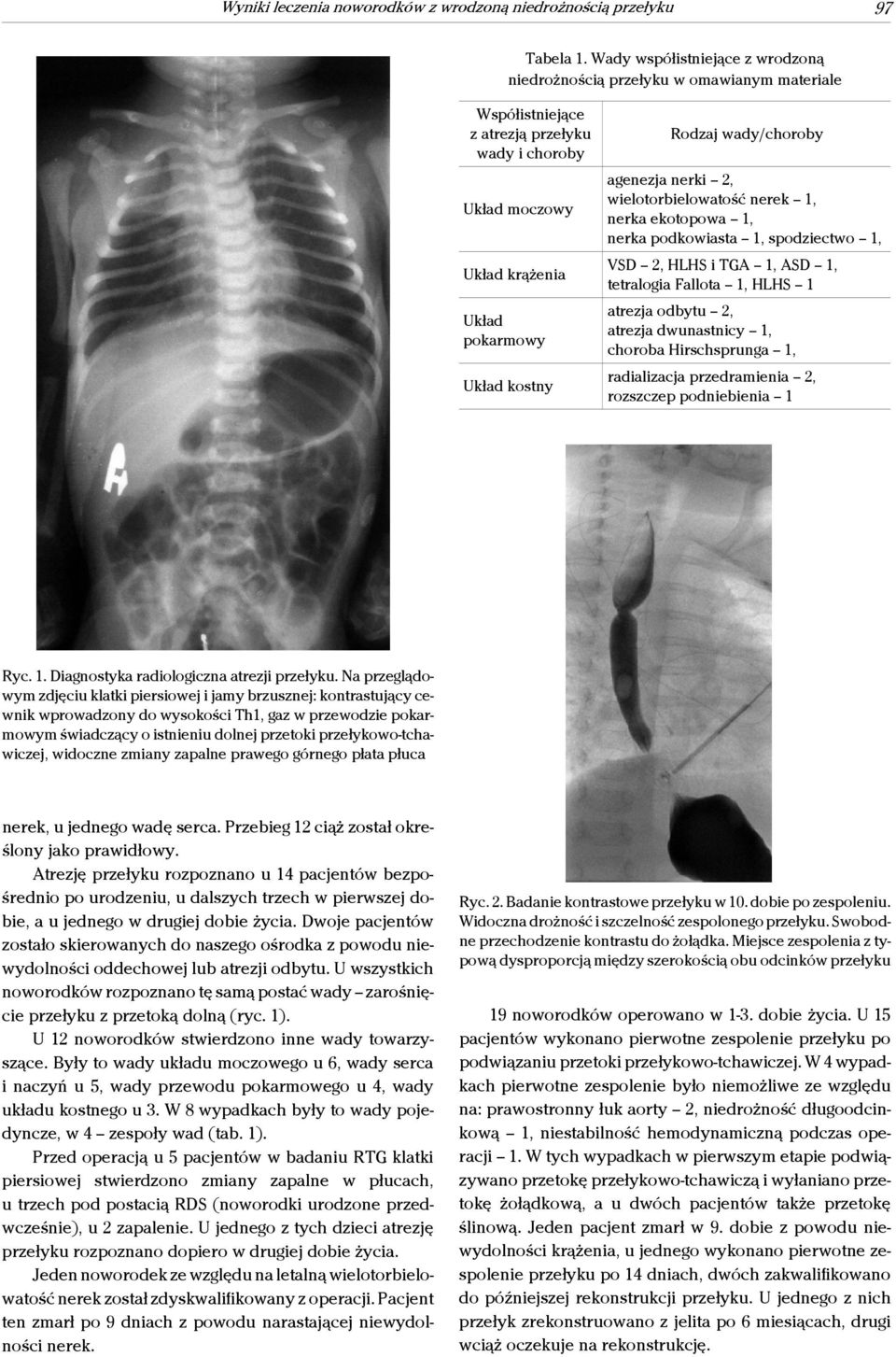wady/choroby agenezja nerki 2, wielotorbielowatość nerek 1, nerka ekotopowa 1, nerka podkowiasta 1, spodziectwo 1, VSD 2, HLHS i TGA 1, ASD 1, tetralogia Fallota 1, HLHS 1 atrezja odbytu 2, atrezja