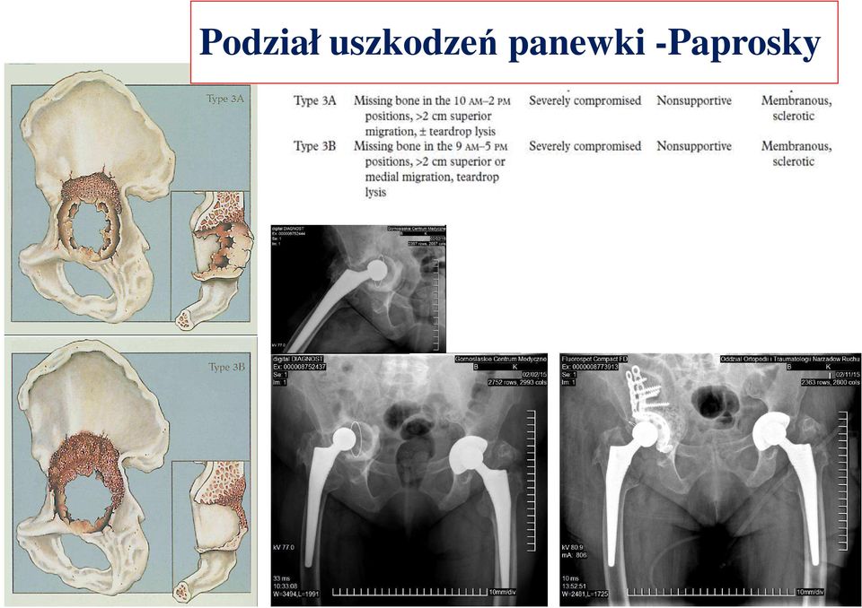 panewki