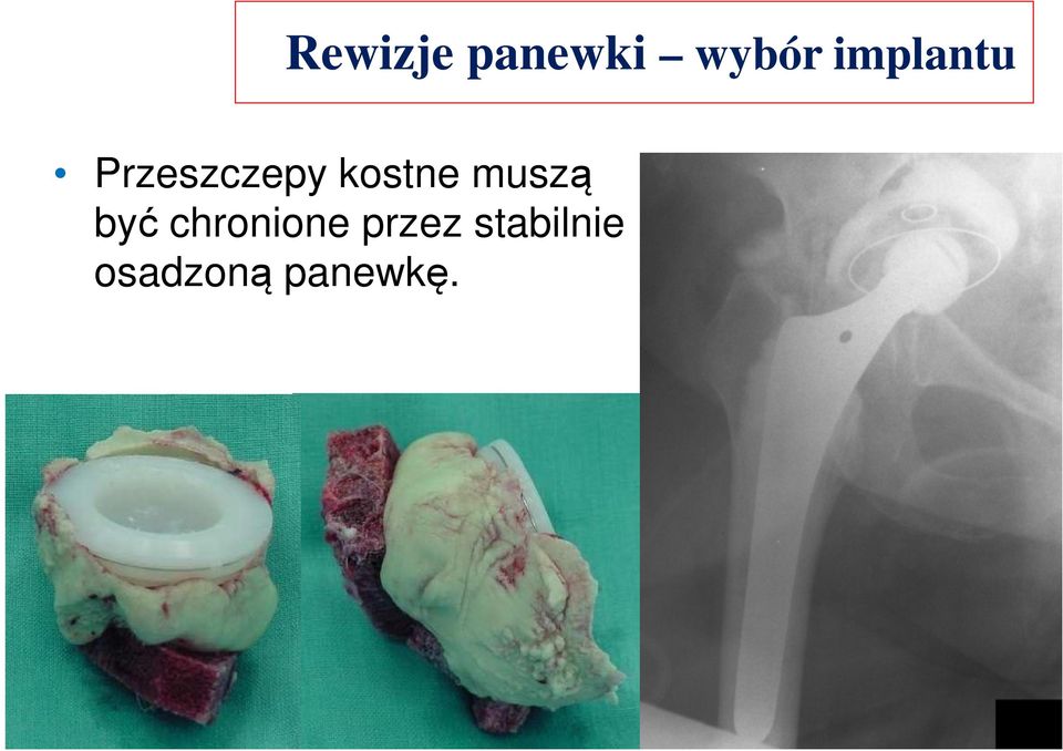 kostne muszą być