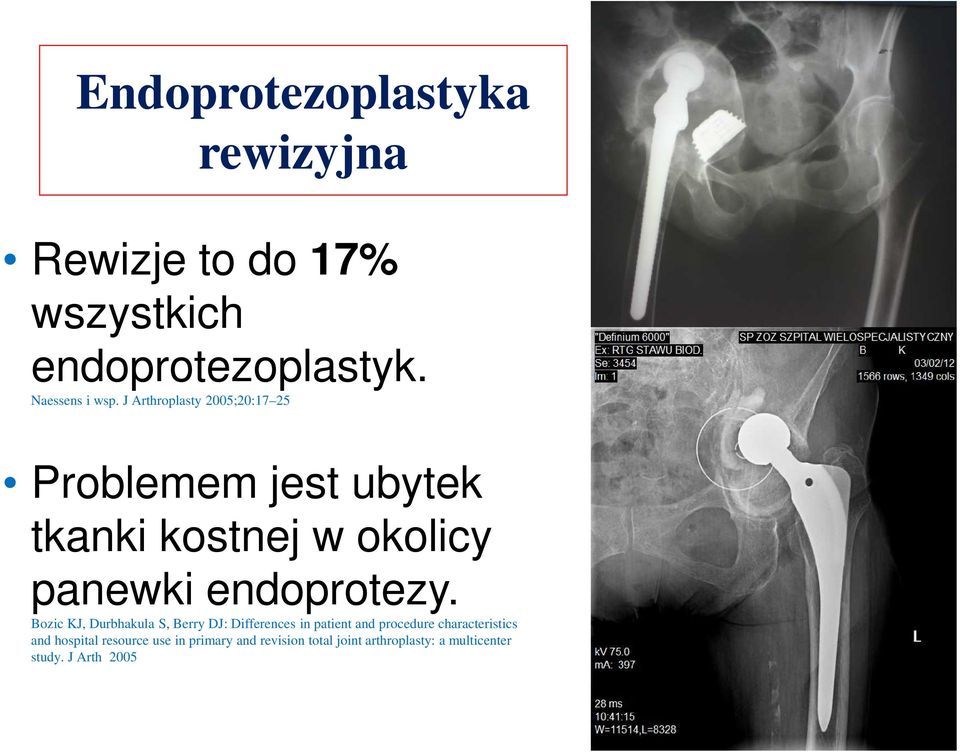Bozic KJ, Durbhakula S, Berry DJ: Differences in patient and procedure characteristics and