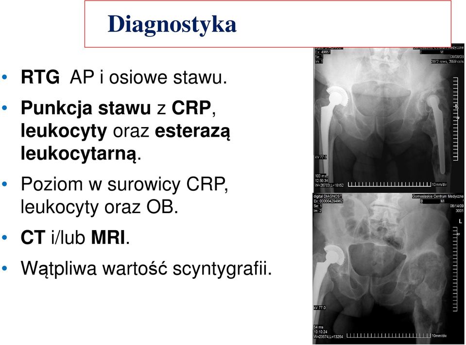 leukocytarną.