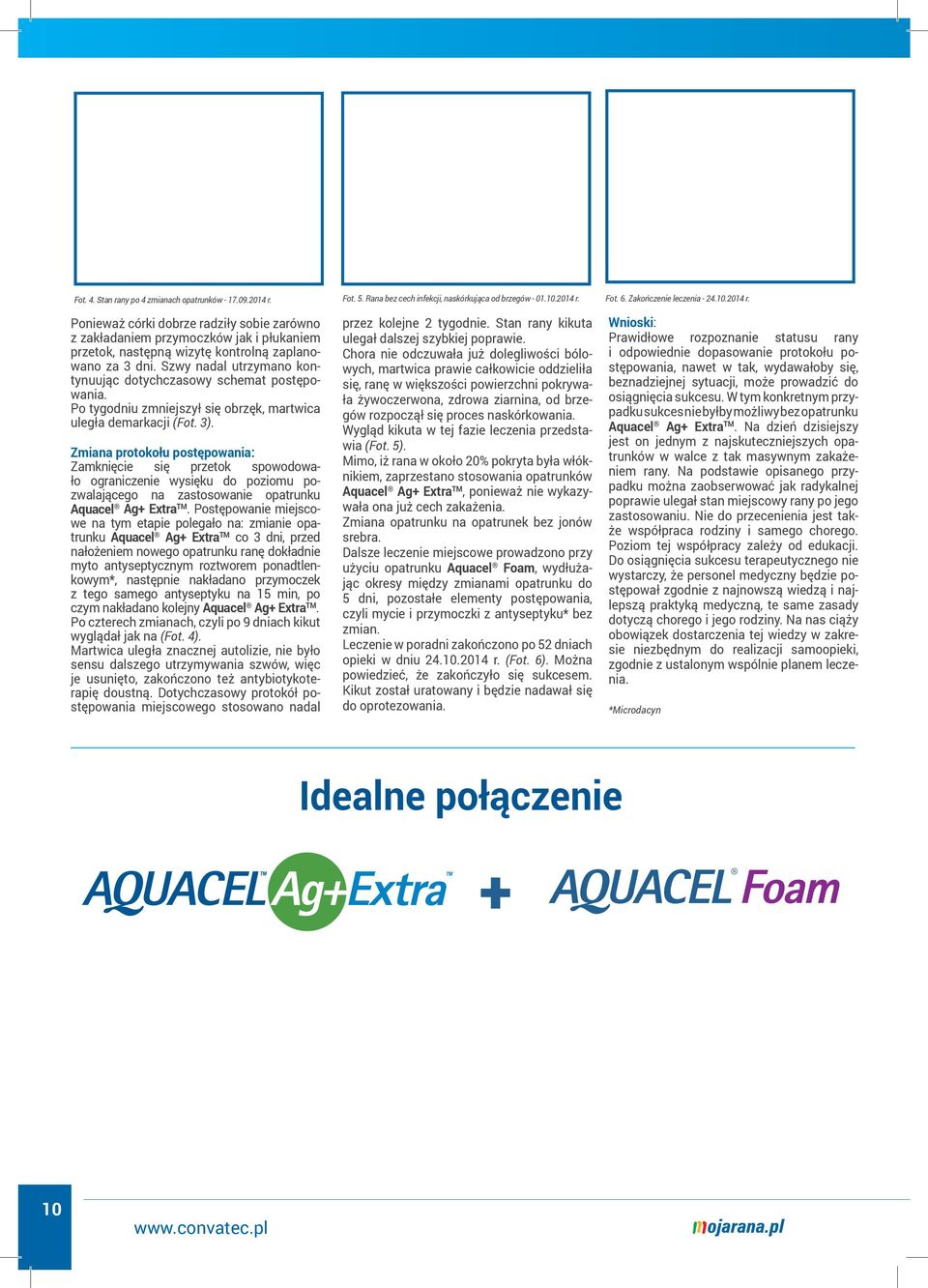Fot. 6. Zakończenie leczenia - 24.10.2014 r. Ponieważ córki dobrze radziły sobie zarówno z zakładaniem przymoczków jak i płukaniem przetok, następną wizytę kontrolną zaplanowano za 3 dni.