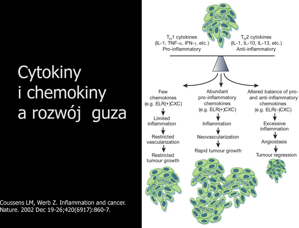Inflammation and cancer.