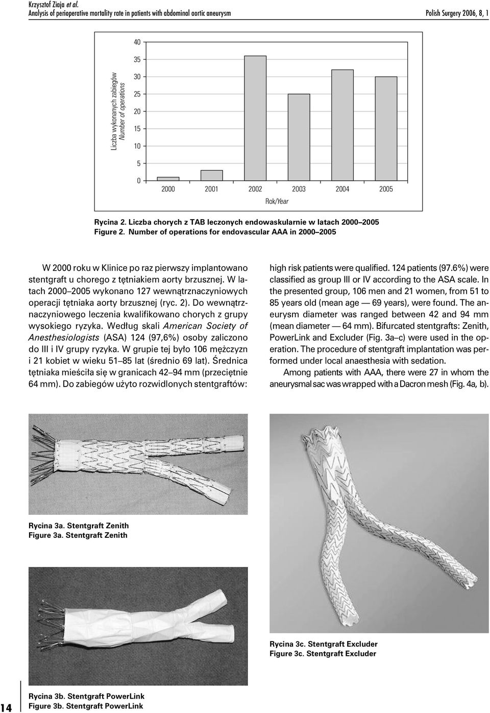 2003 2004 2005 Rok/Year Rycina 2. Liczba chorych z TAB leczonych endowaskularnie w latach 2000 2005 Figure 2.