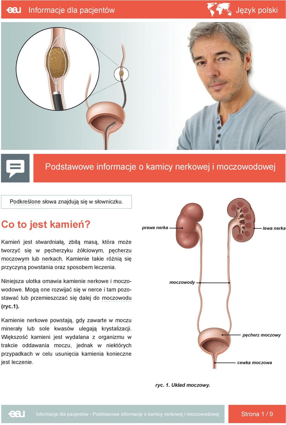 Kamienie takie różnią się przyczyną powstania oraz sposobem leczenia. Niniejsza ulotka omawia kamienie nerkowe i moczowodowe.