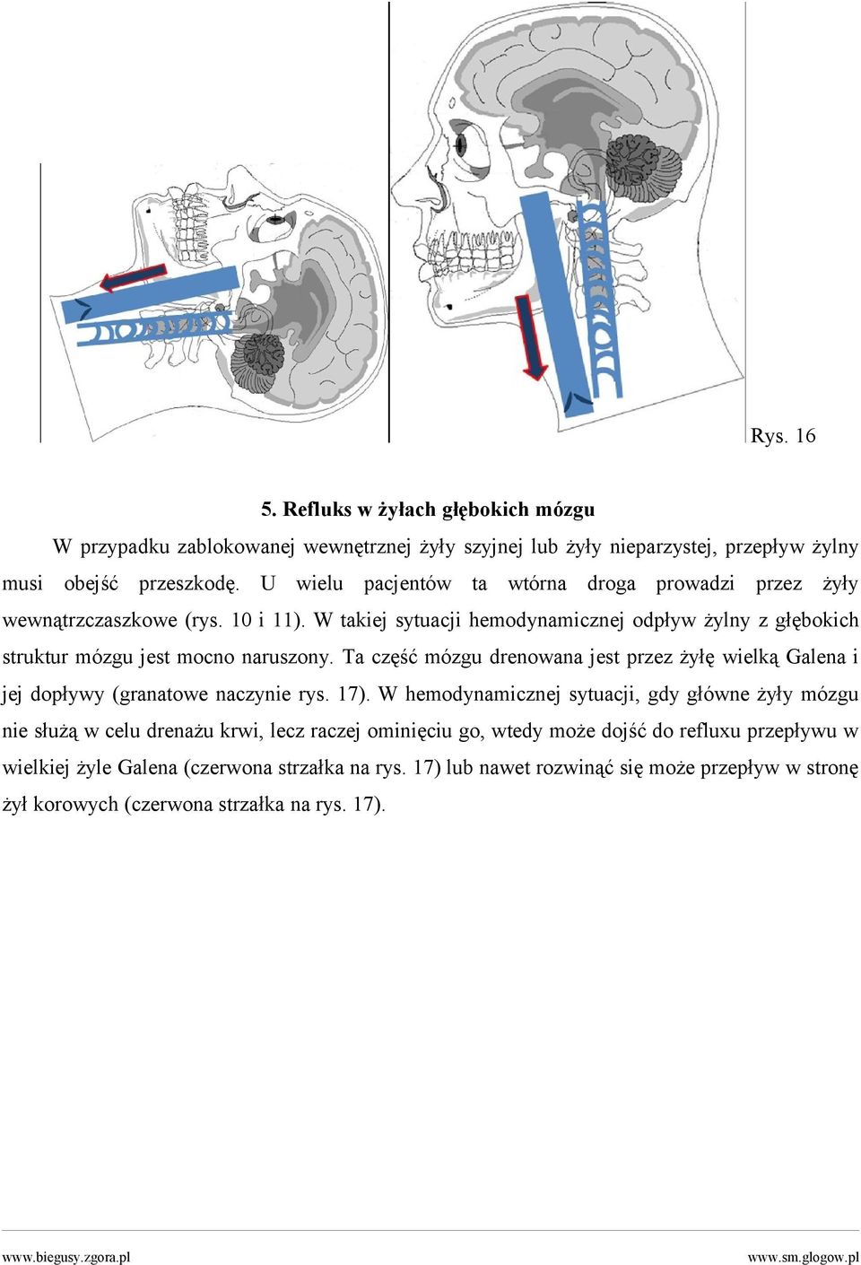 W takiej sytuacji hemodynamicznej odpływ żylny z głębokich struktur mózgu jest mocno naruszony.