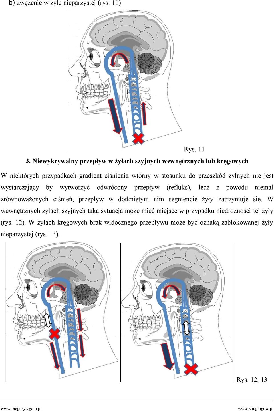 żylnych nie jest wystarczający by wytworzyć odwrócony przepływ (refluks), lecz z powodu niemal zrównoważonych ciśnień, przepływ w dotkniętym nim