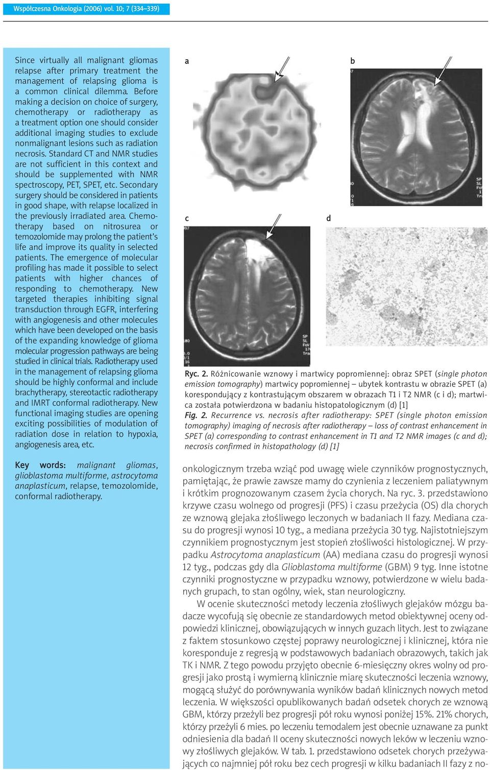 necrosis. Standard CT and NMR studies are not sufficient in this context and should be supplemented with NMR spectroscopy, PET, SPET, etc.